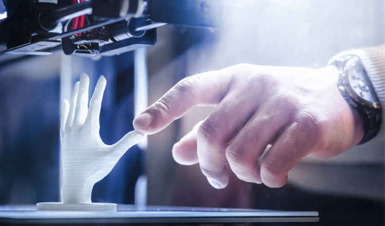 Hand prosthesis in 3D printing